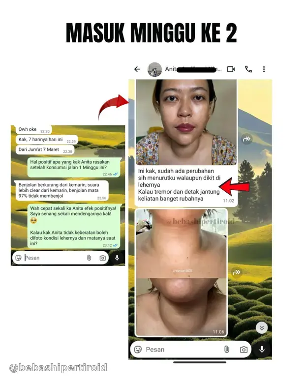 Perubahan gejala dan kondisi Anita pada minggu kedua