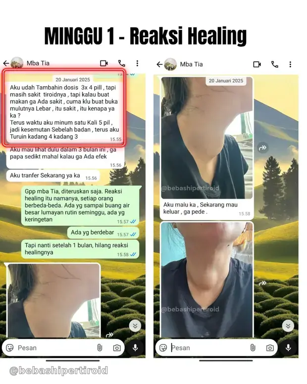 Kondisi Tia pada minggu pertama proses pemulihan