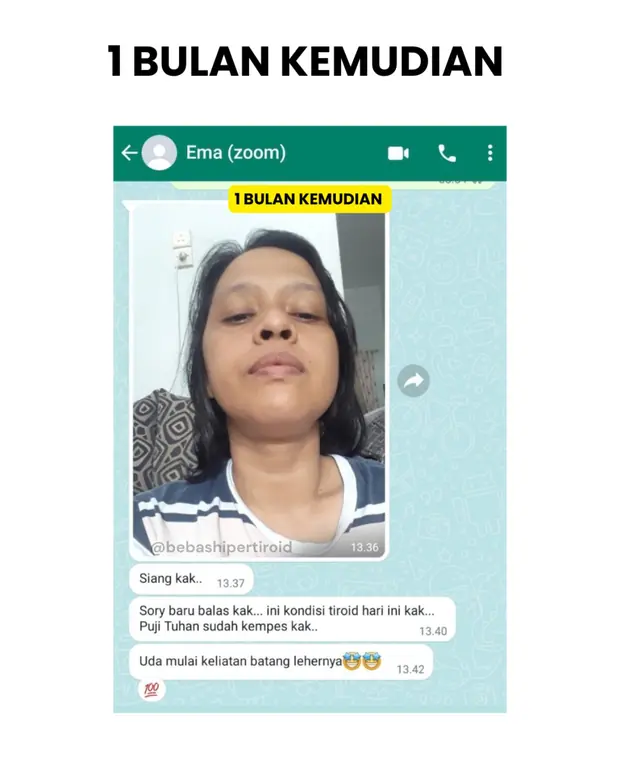 Perubahan kondisi Ema satu bulan kemudian