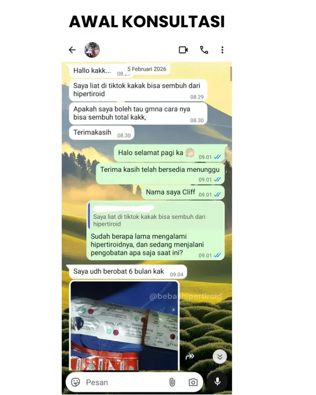 Kondisi awal Priska saat konsultasi setelah satu tahun mengalami hipertiroid Graves