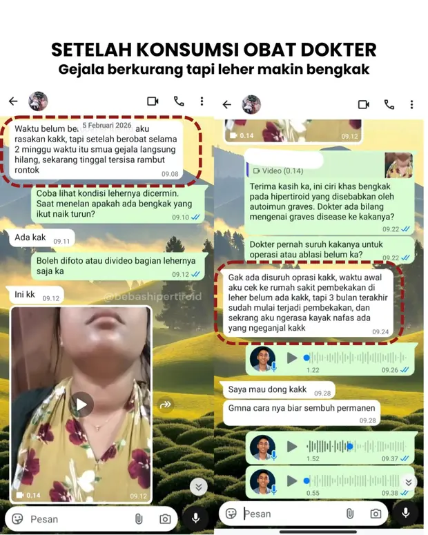 Kondisi leher Priska yang semakin membengkak meski gejala hipertiroid berkurang