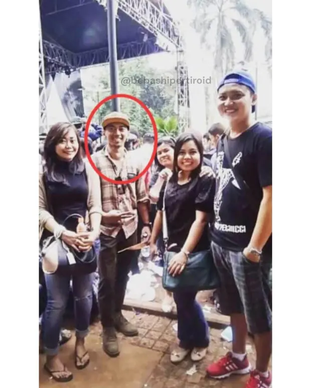 Kondisi Cliff sebelum pulih dari hipertiroid, foto 4