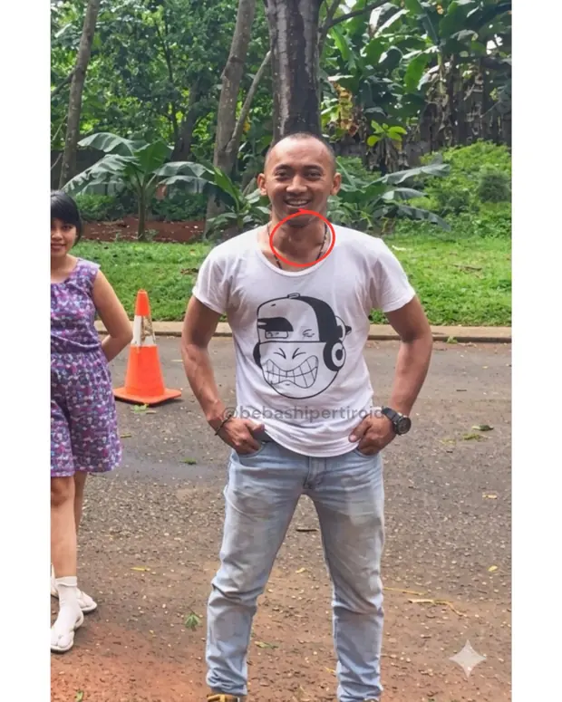 Kondisi Cliff sebelum pulih dari hipertiroid, foto 8