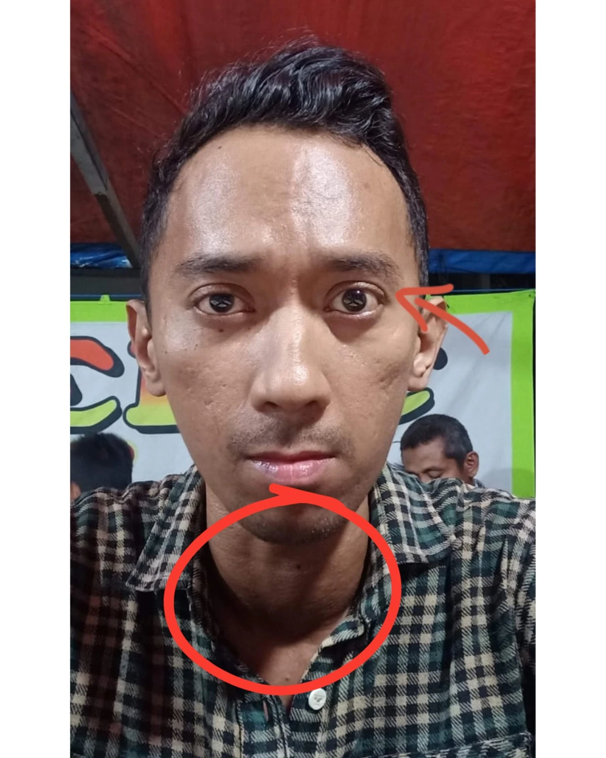 Kondisi Cliff sebelum pulih dari hipertiroid, foto 11